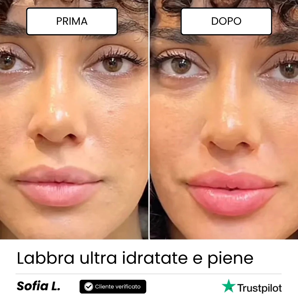 Lip Roller Labbra + Siero