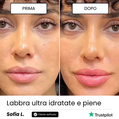 Lip Roller Labbra + Siero / Full Lips™