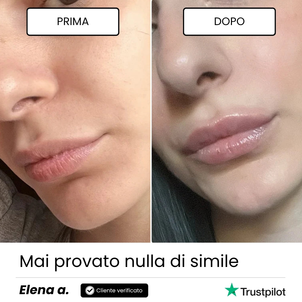 Lip Roller Labbra + Siero