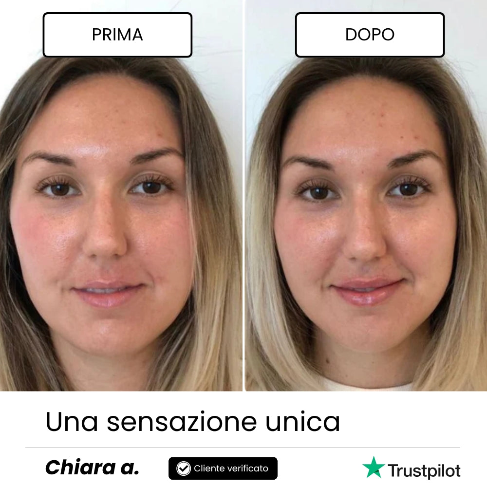 Lip Roller Labbra + Siero