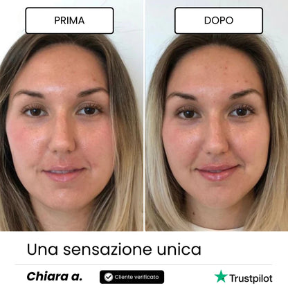 Lip Roller Labbra + Siero / Full Lips™