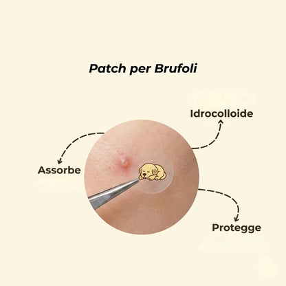 SOS Pimple Patch™ - Sticker Anti Brufoli