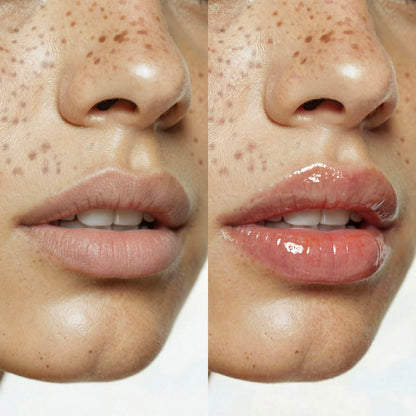 LIP PLUMPER | Full Lips™