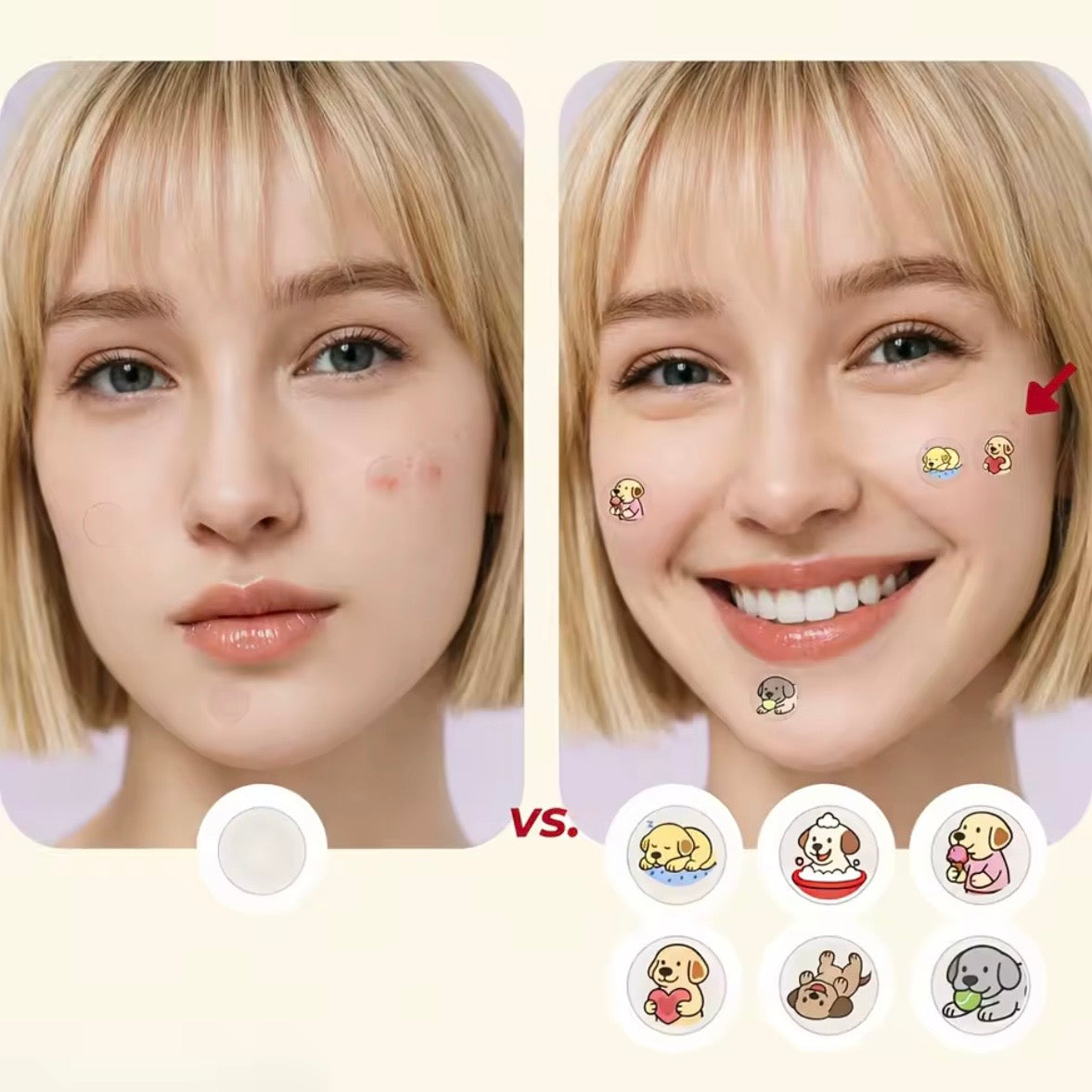 SOS Pimple Patch™ - Sticker Anti Brufoli