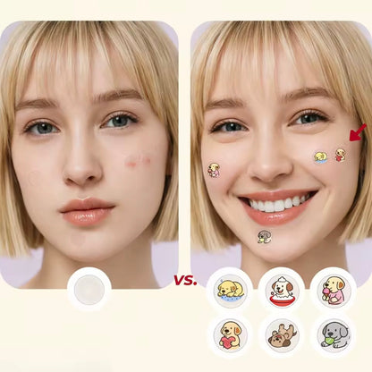 SOS Pimple Patch™ - Sticker Anti Brufoli