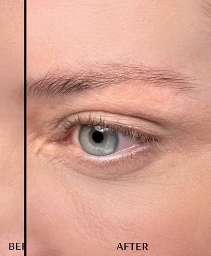 ROLLER RICRESCITA SOPRACCIGLIA/CAPELLI + VITAMINE IN CAPSULE / Full Lips™